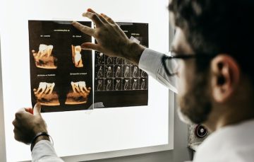 Dental X-Rays Image