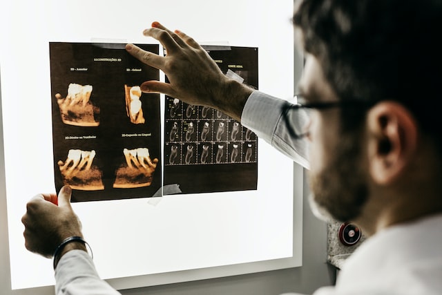Dental X-Rays Image